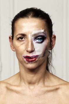 Gewichtsverlust Chirurgie Albuquerque nm