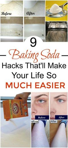 9 Baking Soda Hacks That You Need To Know. Wow! These baking soda cleaning tips are so helpful! I also really like the different things you can use it for in your health and beauty routine. 9 Baking Soda Hacks That You Need To Know. Wow! These baking soda cleaning tips are so helpful! I also really like the different things you can use it for in your health and beauty routine.