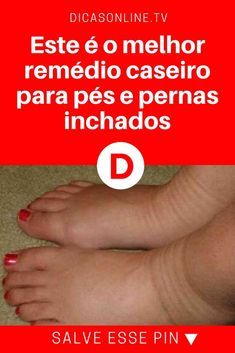 Remédios caseiros para tratamento de inchaço nas pernas