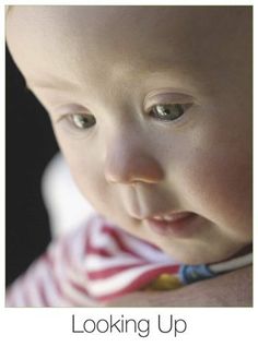 Mia facial syndrome suggest you Useful Mia facial syndrome commit