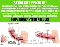 Pin By Claudio Grisanty On Medical Peyronies Disease Beauty