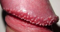 my get How dick rid on to of pimples