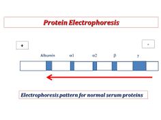 understanding and interpreting the serum protein electrophoresis serum electophoresis