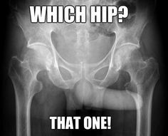 Xray Humor Radiology Humor Its Terrible When It Even Shows Up On An X Ray Xray Humor Radiology Humor Its Terrible When It Even Shows Up On An X Ray