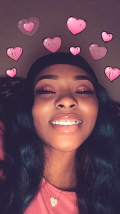 98 best cute brace face images brace face braces colors cute braces colors for light skins