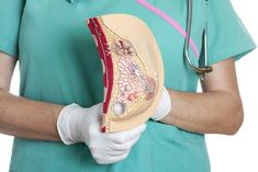 Tamoxifen und Gewichtsverlust Tamoxifen und Gewichtsverlust