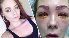 16 Yr Old Teenager Almost Blinded After Hair Dye Fail Allergic Reaction Hair Fails Dyed Hair Hair