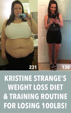Will insurance pay for weight loss surgery picture 1