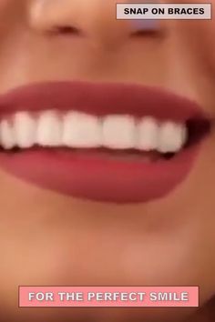 Facettes dentaires - pour un magnifique sourire [Vidéo Facettes dentaires - pour un magnifique sourire [Vidéo