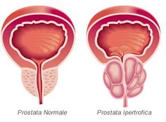 prostatico specifico psalms
