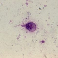 el giardia lamblia es un tipo de ameba