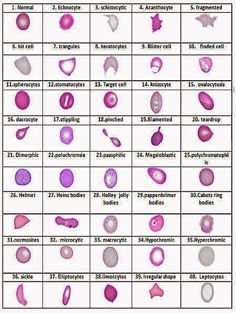 photos google search blood histology red blood cells abnormal rbc morphology