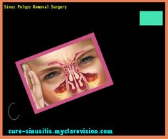 Natural Remedies For Sinus Drainage During Pregnancy Natural Remedies For Sinus Drainage During Pregnancy