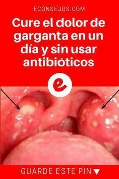 39 Ideas De Dolor Garganta Consejos Para La Salud Salud Y Bienestar Remedios Naturales