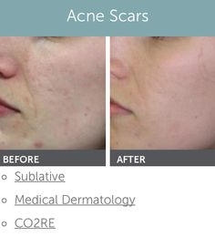 Apologise, that Facial rejuvenation wyoming pity Has analogues? Facial rejuvenation wyoming advise