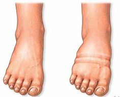 una prostata attiva significa salute