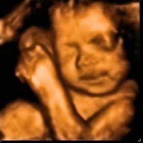 Inner Reflections 3D / 4D Ultrasound Studio