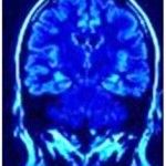 Associated Neurologists, P.C.