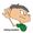 Audiology Bangladesh