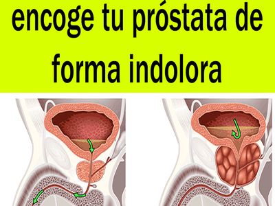 próstata agrandada y café embarazada próstata agrandada y café embarazada