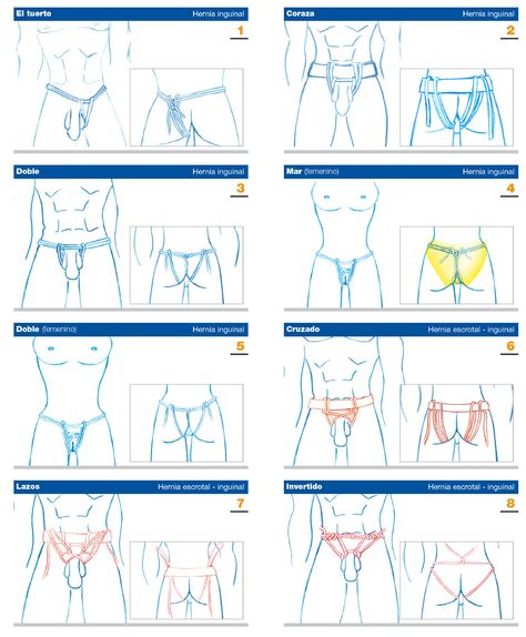 Cerrar Hernia Inguinal Sin Cirugía Curar Hernia Inguinal Curar Hernia Dolor De Espalda