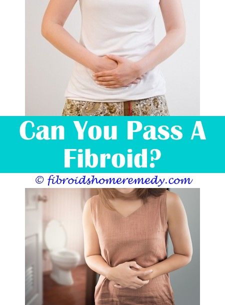 Can You Pass A Fibroid Can You Pass A Fibroid During Your Period Fibroids Uterine Fibroids Uterine Fibroids Symptoms
