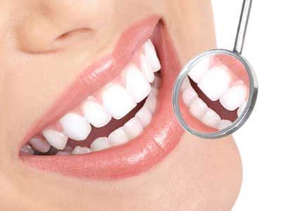 Berapa Harga Veneer Gigi Yang Biasa Dikerjakan Dokter Di Klinik