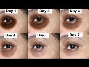 En Seulement 7 Jours Vous Serez Tres Etonne Eliminer Les Cernes Avec Ce Remede100 Naturel Youtube Argan Yagi Cilt Bakimi Gozler En Seulement 7 Jours Vous Serez Tres Etonne Eliminer Les Cernes Avec Ce Remede100 Naturel Youtube Argan Yagi Cilt Bakimi Gozler