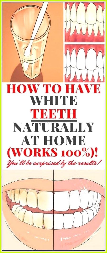 Natural cure for white spots on teeth