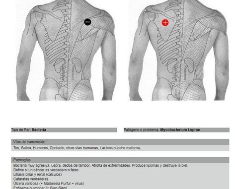 TRATAMENTUL CU LASER AL VARICOZEI | incomed