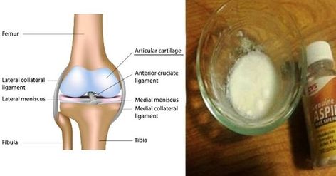 plante medicinale pentru tratamentul articulațiilor ligamentelor și oaselor)