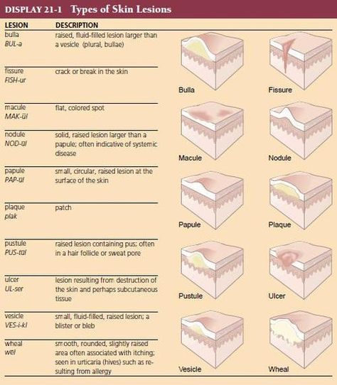 facial lesion dermatology Facial lesion dermatology