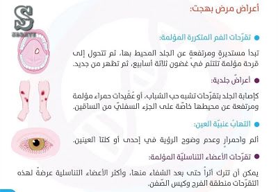 مرض بهجت Paget Blog Health Jabi