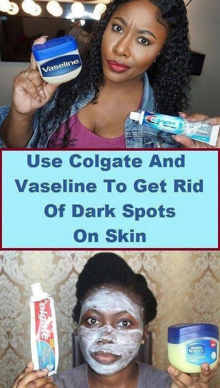 Find Out Who Is Worried About Remove Brown Spots And Why You Should Pay Attention Healthy Medicine Tips Dark Spots On Skin Brown Spots On Skin Dark Spot Remover For Face Find Out Who Is Worried About Remove Brown Spots And Why You Should Pay Attention Healthy Medicine Tips Dark Spots On Skin Brown Spots On Skin Dark Spot Remover For Face