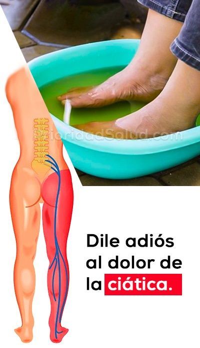 Pierna ciatica sintomas dolor