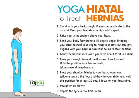 10 Ideas De Hernia Hiatal Tratamiento Hernia Hernia De Hiato Hiato