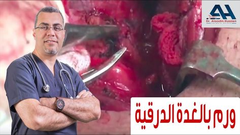 استئصال أورام الغدة الدرقية Fictional Characters Character John