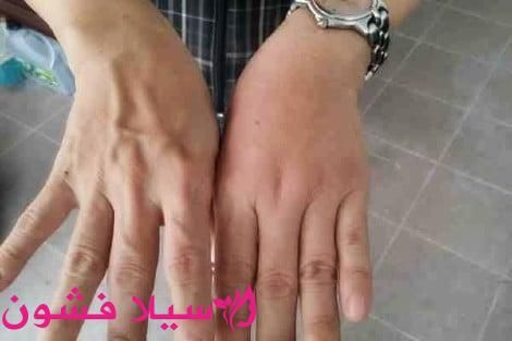 خلطات لتسمين اليدين سيلا فشون