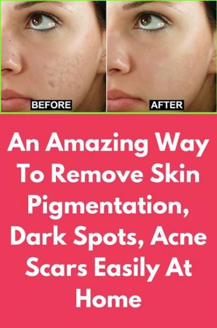 Pin on How to .