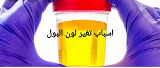 تغير لون البول صحة الاسرة Vitamin Water Bottle Drink Bottles Water Bottle