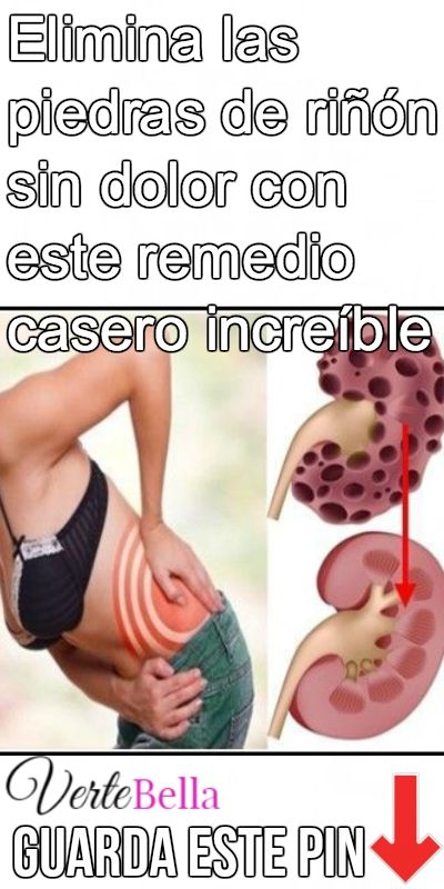 40 Ideas De Piedras En El Riñon Piedras En El Riñon Riñones Riñones Remedios