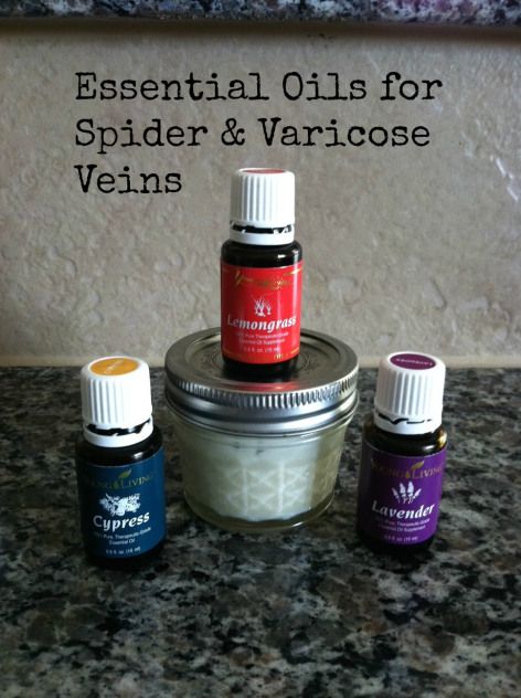 varicose vodka