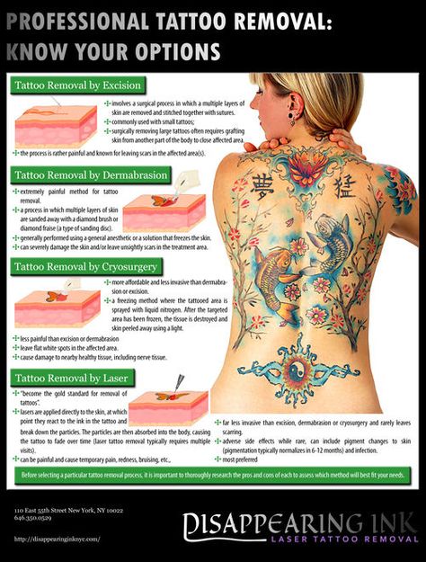 tattoo removal cream proces wrecking balm tattoo removal cream tattoo removal cream proces wrecking balm tattoo removal cream