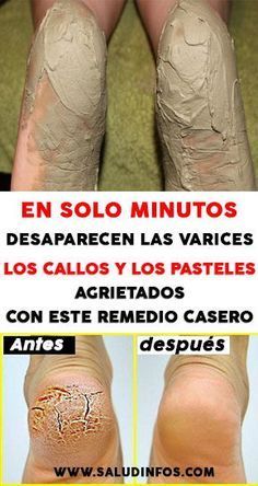 Pin En Circuitos