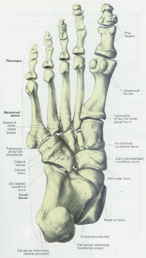 láb metatarsalis arthritis