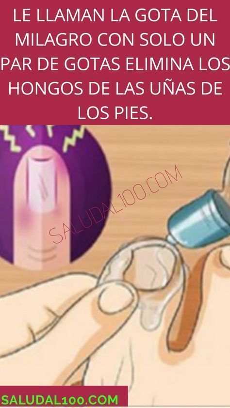 Las caries con en el cerebro se llaman