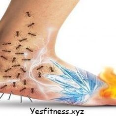 dolor de pierna lyme herx