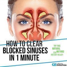 how to stop sinuses from draining into throat how to stop sinuses from draining into throat
