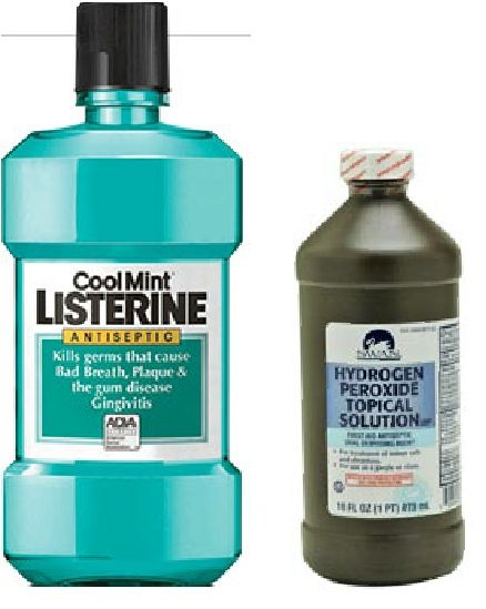 Peroxide strep throat