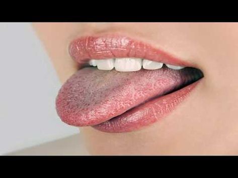 Green coated tongue YouTube Green coated tongue YouTube